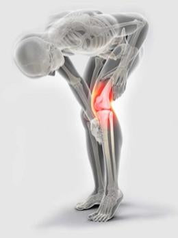 knee replacement surgery